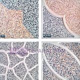 موزائیک استاندارد موزائیک استاندارد